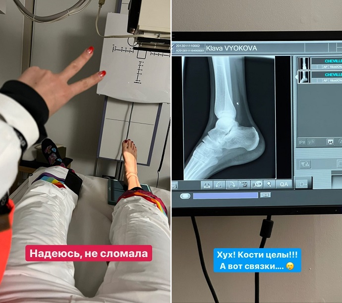 Клава кока попала в дтп