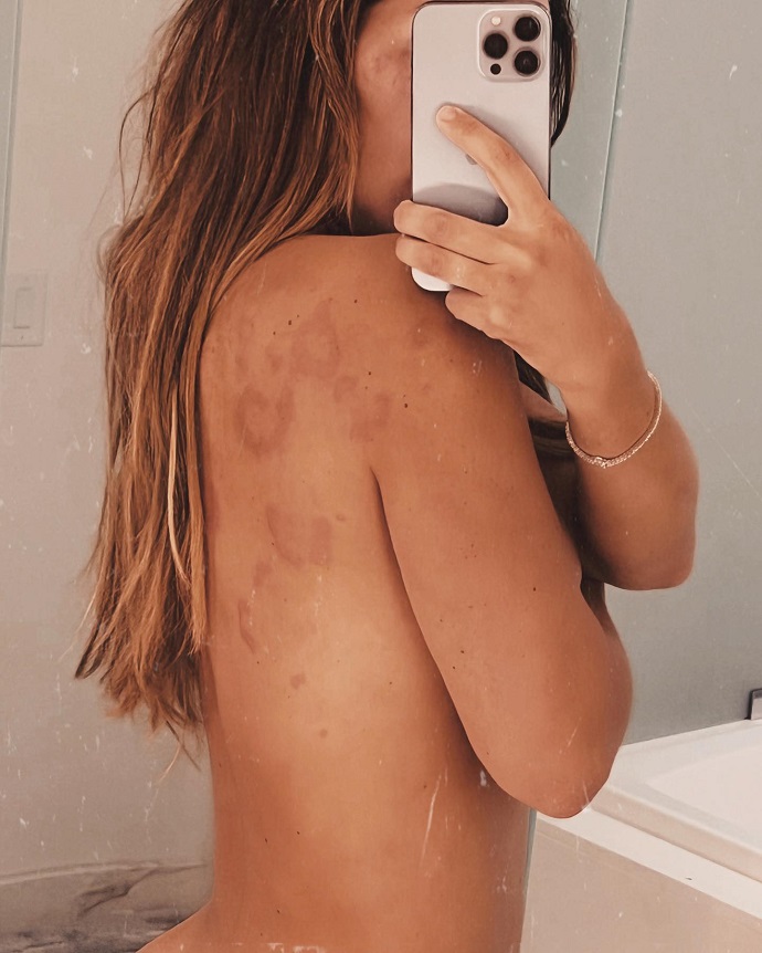 Аня Седокова хотела показать спину, но, по привычке, показала грудь Аня Седокова хотела показать спину, но, по привычке, показала грудь