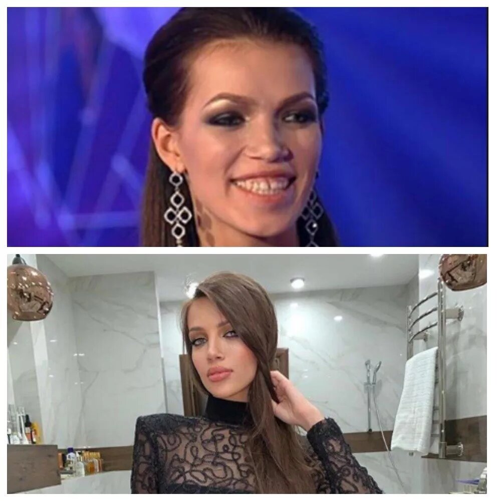 «Крутятся по часовой стрелке»: участница Дом-2 Инесса Шевчук проиграла суд за свою силиконовую грудь