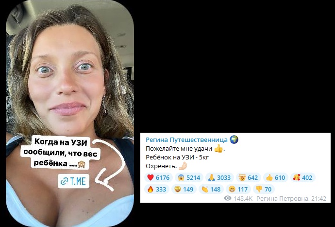 Объявив о том, что идет на рекорд, беременная Регина Тодоренко пропала из соцсетей