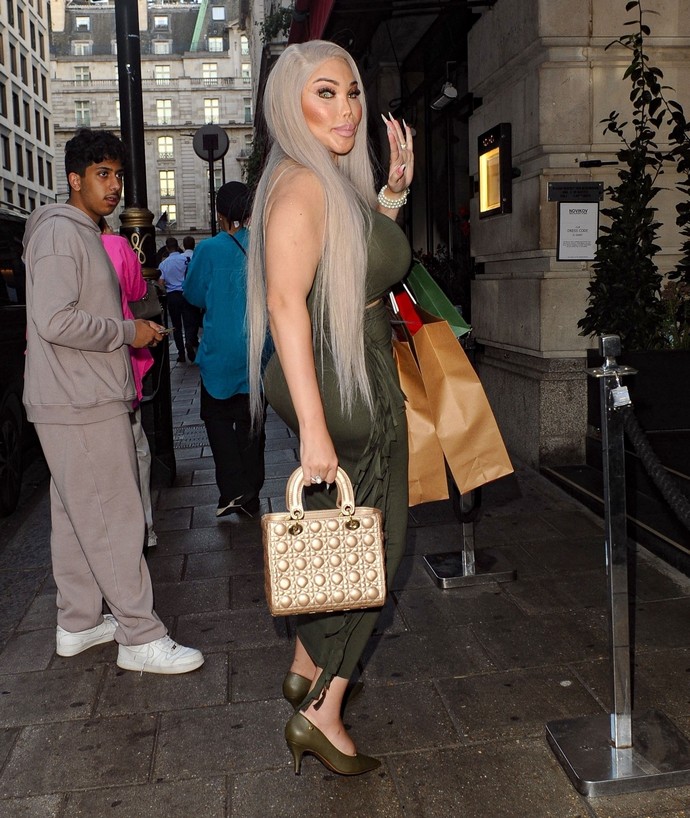 «Живой Кен» или «живая Барби»? Джессика-Родриго Алвес слетала в Баку, чтобы получить «глаза Беллы Хадид»