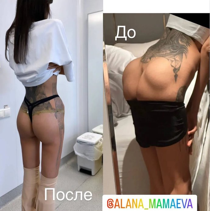 Экс-жена Павла Мамаева Алана впервые вышла в свет после пластической операции на ягодицы 