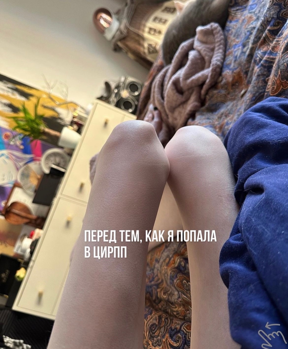 "Я недовольна своим лицом": Алена Шишкова призналась, что лечилась от анорексии и булимии 
