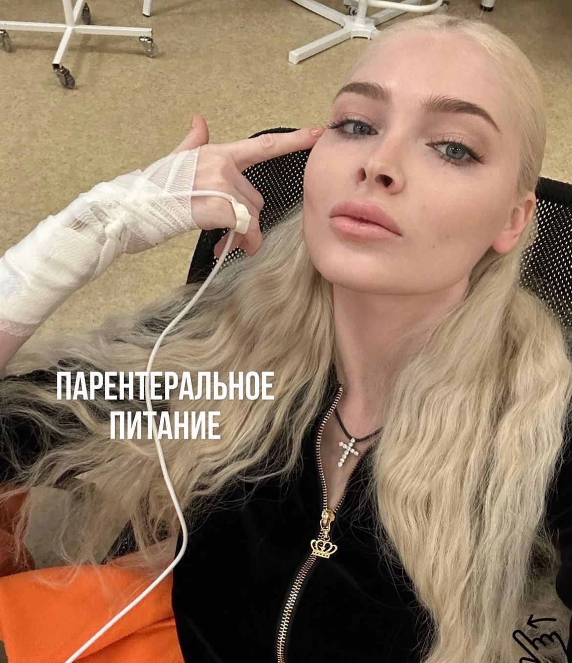 "Я недовольна своим лицом": Алена Шишкова призналась, что лечилась от анорексии и булимии 
