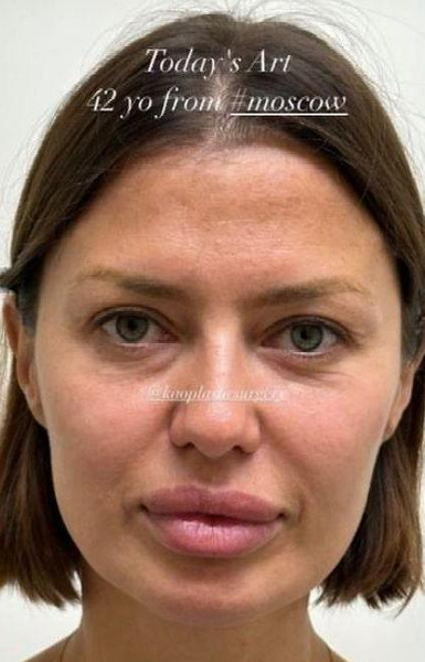 Наркоманка: Виктория Боня ответила на нападки Аланы Мамаевой
