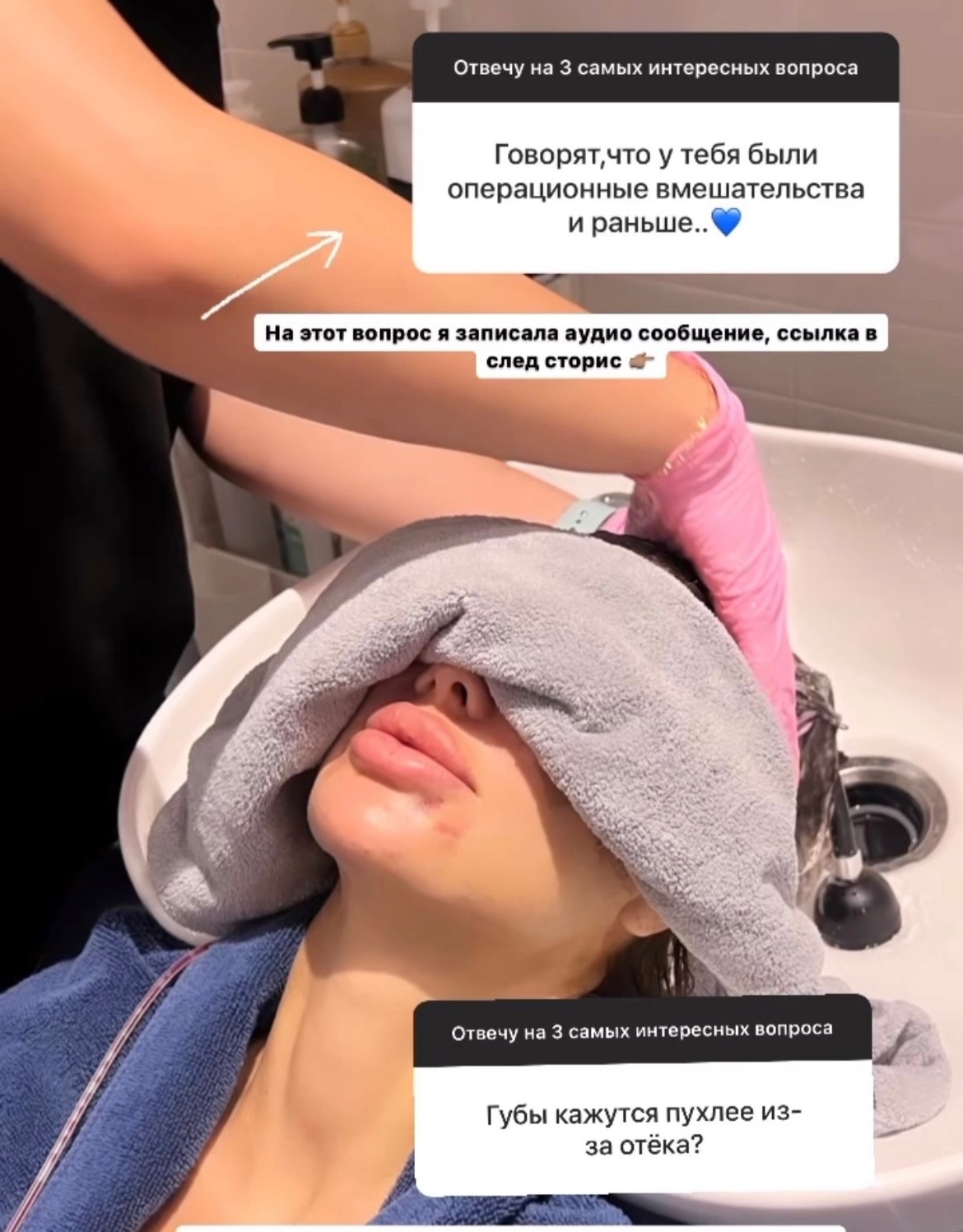 Виктории Боне увеличили губы без ее ведома
