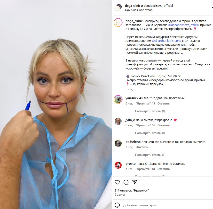 После пластических операций лицо Даны Борисовой стало еще шире